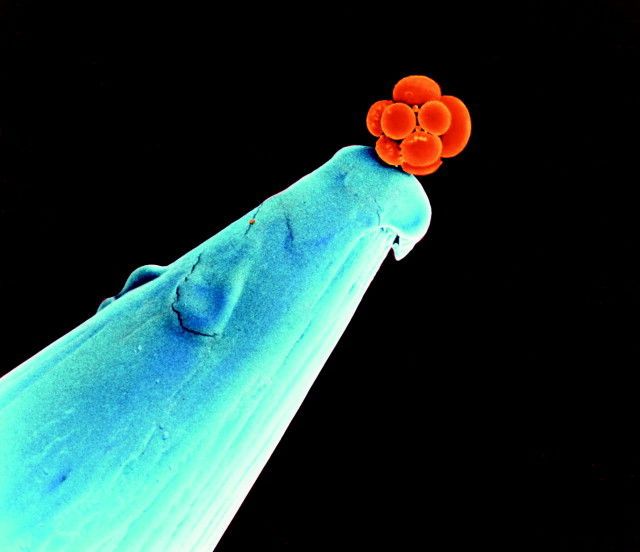 An early human embryo on the tip of a needle photo epic_photos_that_are_truly_fascinat_zps35ad4cdc_1.jpg