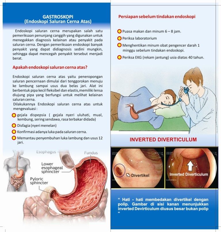 Gastroskopi2 photo Gastroskopi-B_zpsvtb5yxdg.jpg