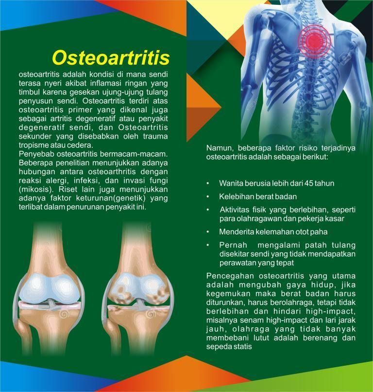 Osteoartritis2 photo Osteoartritis2_zps6ltxocpl.jpg